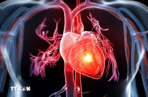 Bệnh tim mạch khiến 10 000 người châu Âu tử vong mỗi ngày