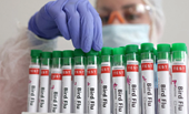 WHO xác nhận ca tử vong đầu tiên do cúm gia cầm H5N2