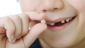 Trẻ mọc răng và thay răng cần lưu ý gì
