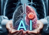 Công cụ AI mới nâng cao chất lượng điều trị ung thư