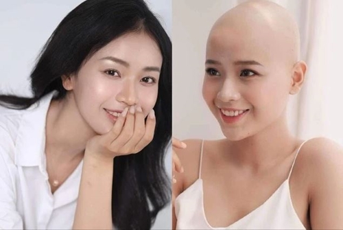 Cô gái từng chiến thắng ung thư nói lý do thi Miss Grand Vietnam