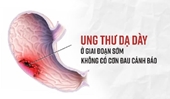 Câu hỏi thường gặp liên quan đến ung thư dạ dày