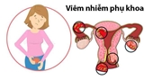 5 nguyên nhân khiến phụ nữ dễ mắc và tái nhiễm bệnh phụ khoa