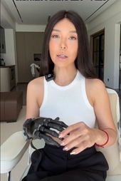 Cô gái với bàn tay robot truyền cảm hứng sống lạc quan