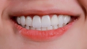 6 cách chống mòn răng khi về già