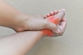 Bệnh gout tấn công người trẻ, bác sĩ chỉ cách phòng ngừa