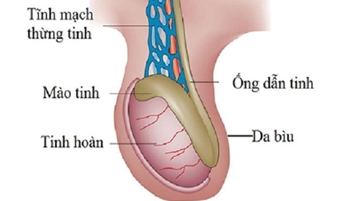 Viêm ống dẫn tinh điều trị như thế nào